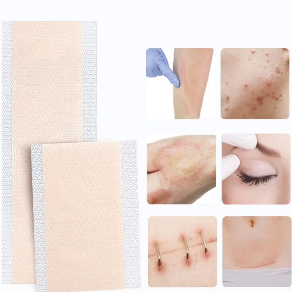 Waterproof Flaw Hide Stickers Invisible Natural Look Scar Flaw Concealing Tapes Convenient Ultra-thin Tattoo Cover Up Sticker