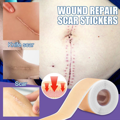 1Roll Reusable Self-Adhesive Silicone Scar Sheet Tape Caesarean Section Trauma Acne Burn Scar Skin Repair Removal Strip Patch