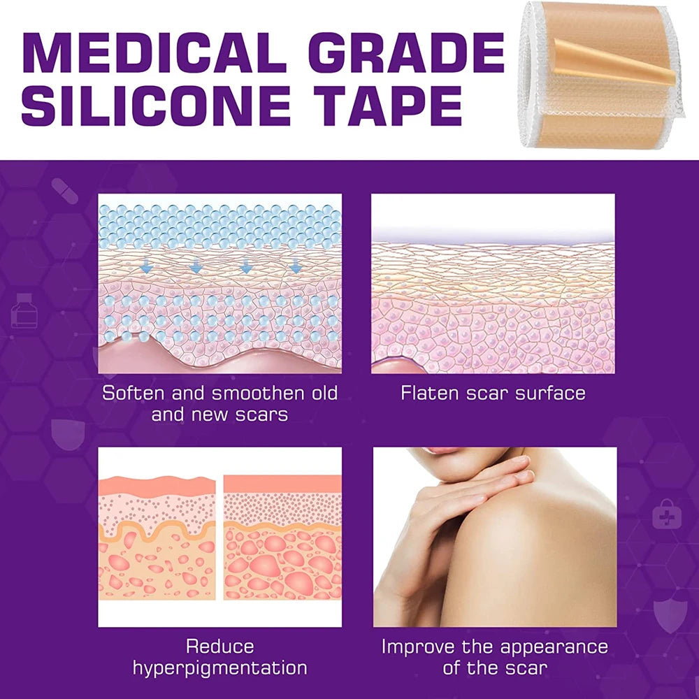 1/2 Professional Silicone Scar Sheets Scars Treatment - Reusable Silicone Scar Strips Type for Keloid,C-Section,Surgery,Acne et